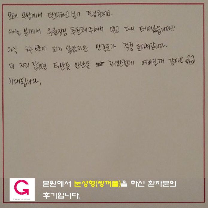 눈성형(쌍꺼풀) 후기입니다.
