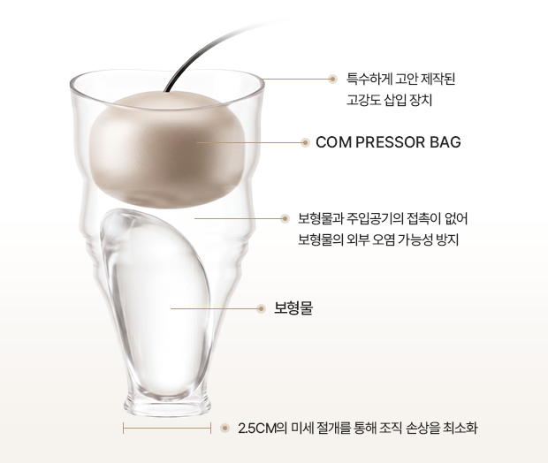 특수하게 고안 제작된 고강도 삽입 장치, Com pressor bag, 보형물과 주입공기의 접촉이 없어 보형물의 외부 오염 가능성 방지, 보형물, 2.5cm의 미세 절개를 통해 조직 손상을 최소화